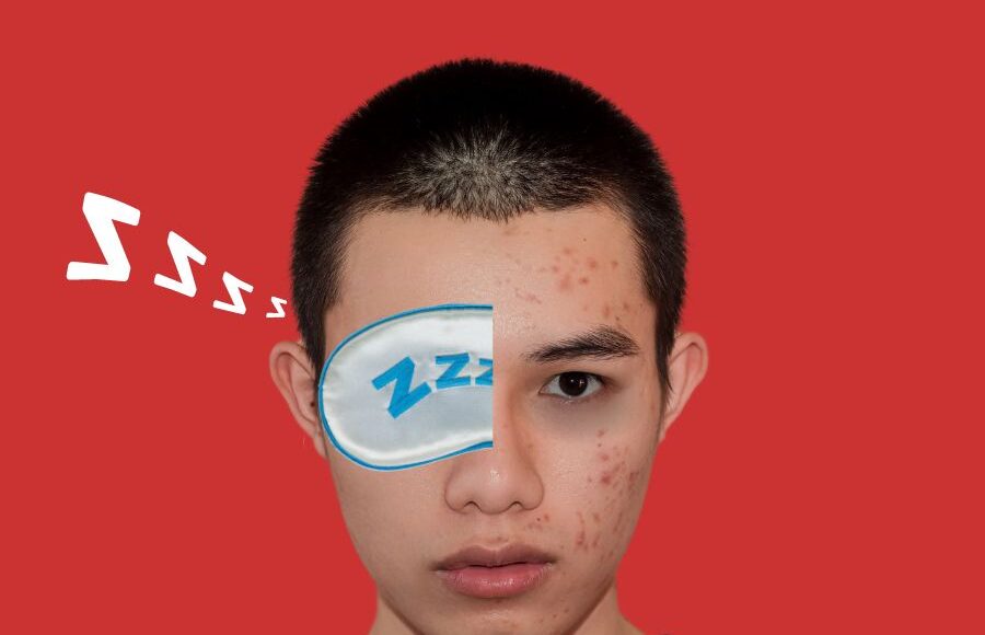 Acne and Sleep: How Sleep Quality Affects Skin Health and Breakouts