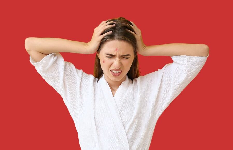 Skin and stress: Uncovering the mind-body connection in acne management