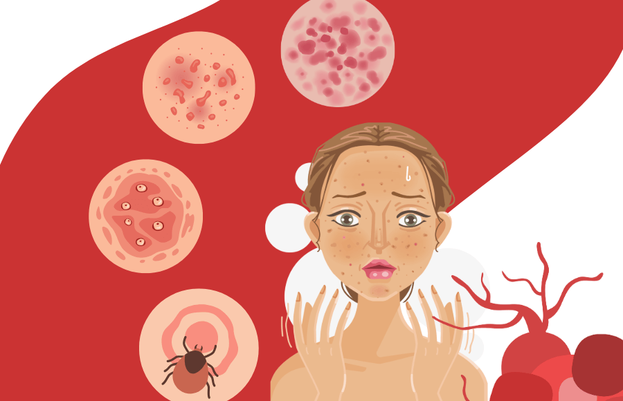 Acne or something else? A dermatologist’s guide to skin conditions
