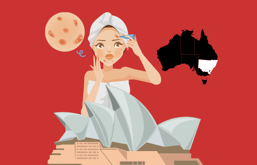 ‘Acne treatment near me in Sydney’: Your guide to clear skin with Acne Express