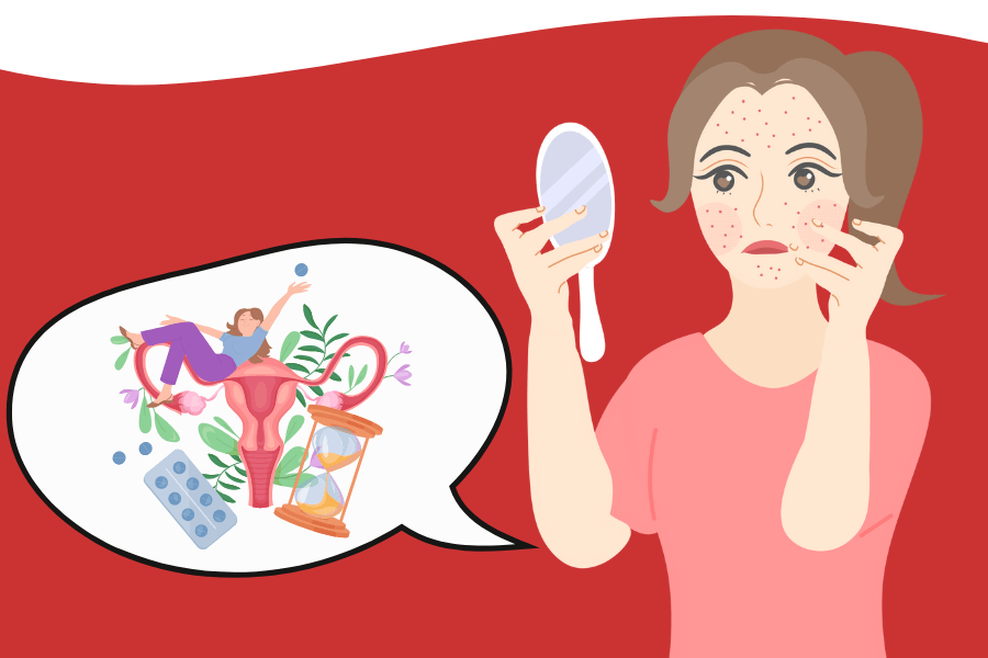 Hormonal acne solutions in Surry Hills: Your path to clearer skin