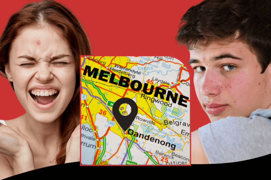 Finding the best teenage acne clinics in Dandenong, Melbourne: Your complete guide to clear skin