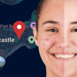 Best Acne Solutions in Newcastle: Clear Skin Treatments & Expert Care