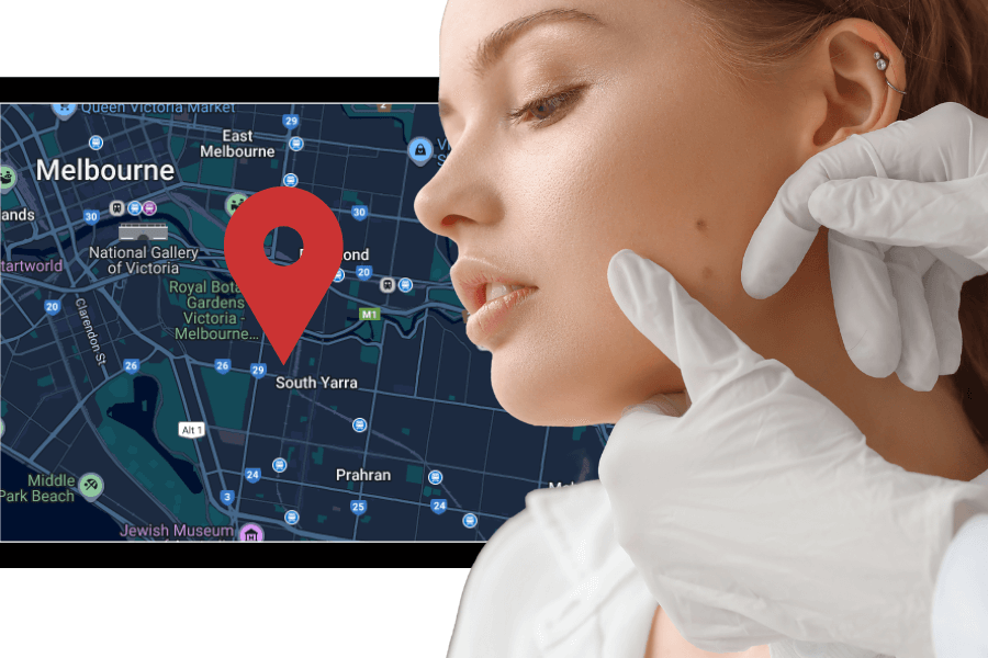 Finding an acne specialist in South Yarra Melbourne: A real guide