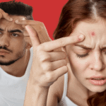 Why do I get pimples on my forehead? Causes, treatment & prevention
