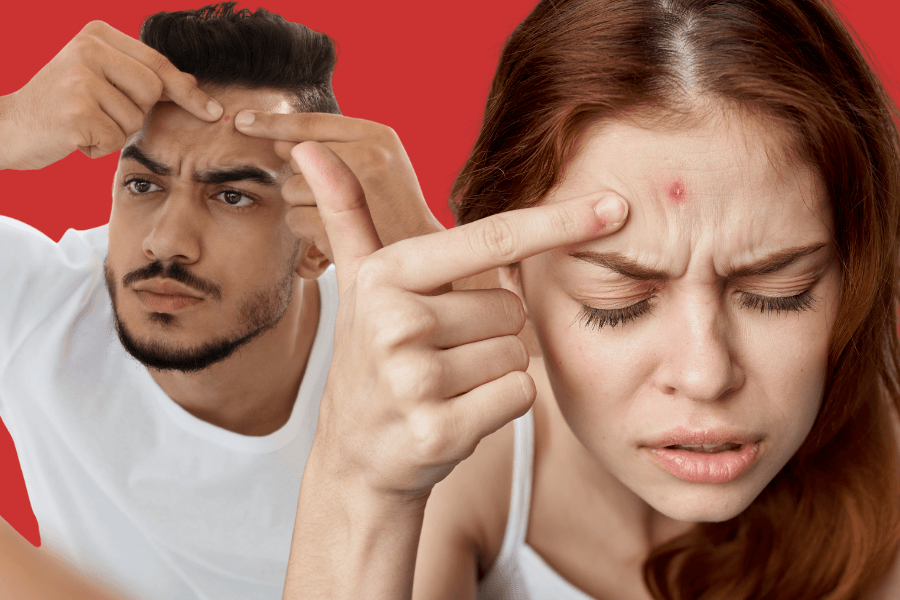 Why do I get pimples on my forehead? Causes, treatment & prevention