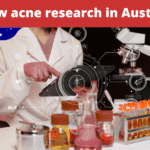 New acne research in Australia What the latest studies mean for your skin (1) New acne research in Australia: What the latest studies mean for your skin