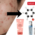 Best Salicylic Acid Cleanser for Acne — Find the Right One for Your Skin Type