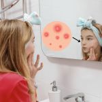 Teenage acne causes: what's really behind your teen's breakouts