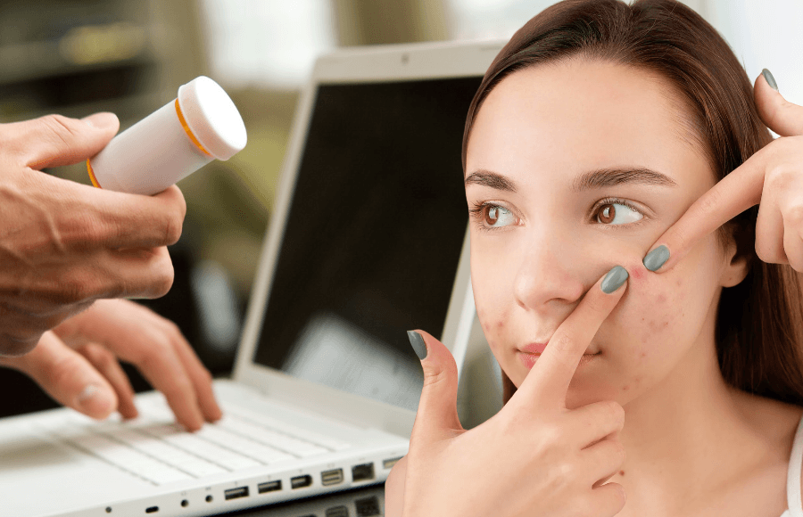 Online acne prescription in Australia: how it works